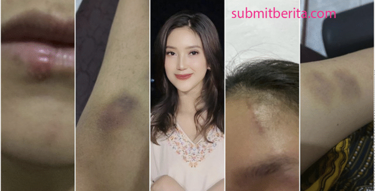 Kasus Dugaan KDRT: Suami Selebgram Adelia Septa Ditahan