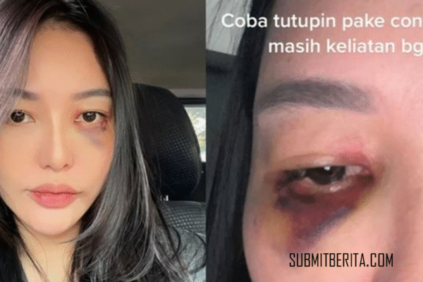 Selebgram Dian