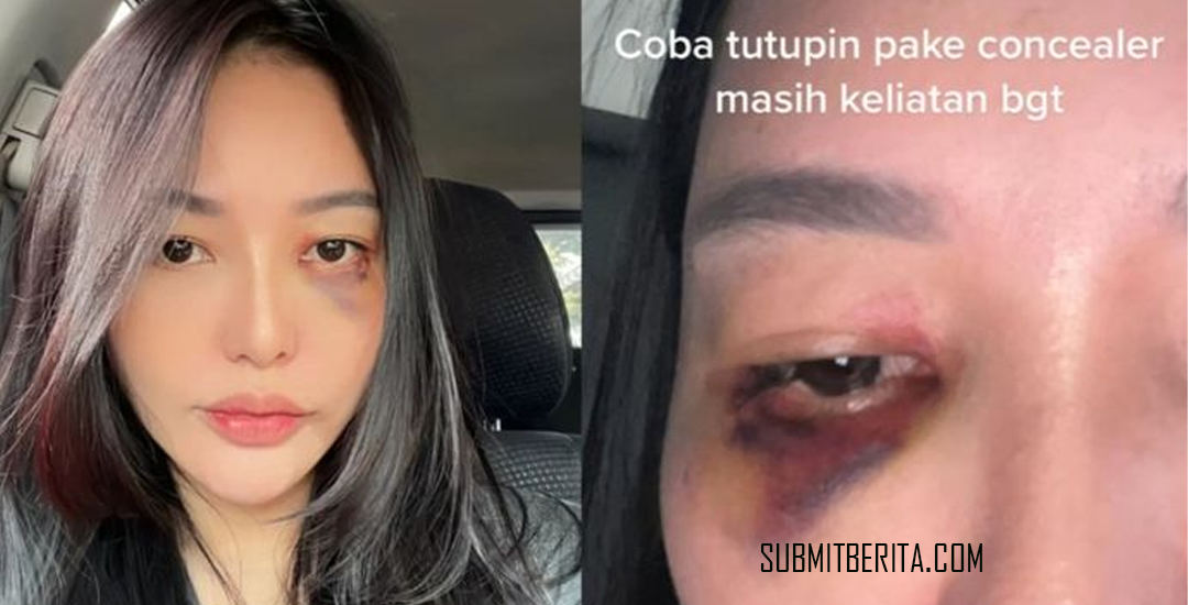 Selebgram Dian